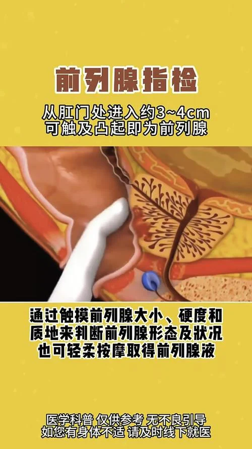 医院如何查前列腺_1
