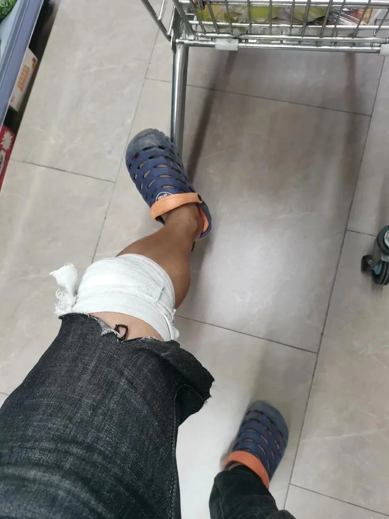 梦见腿流血不止_1