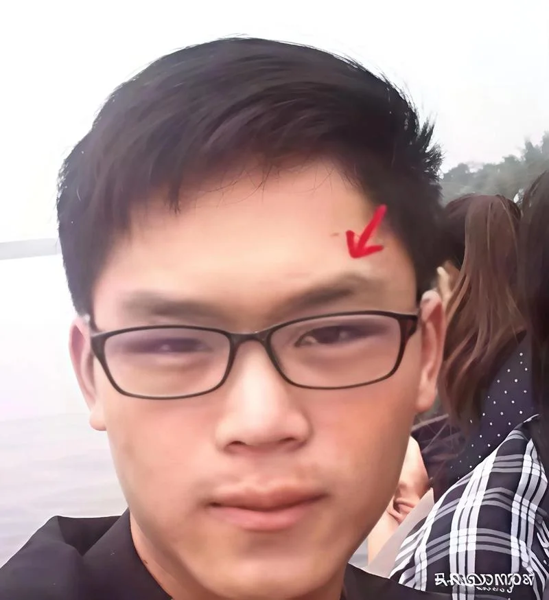 下巴上面有个凹陷面相_1