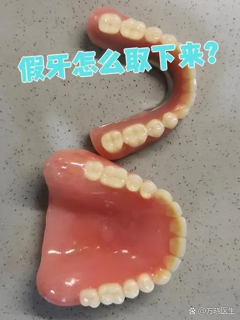 假牙制作哪里学-假牙制作学习指南
