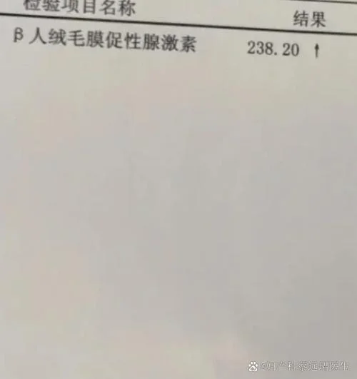 血清人绒毛膜促性腺激素是查什么的_1