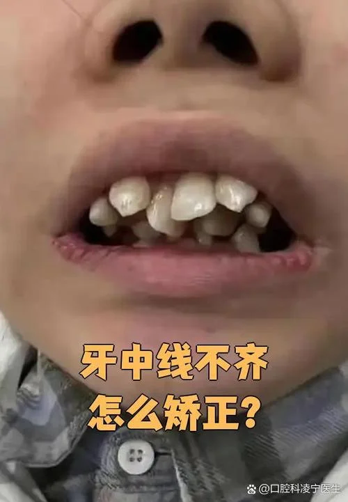 男人牙不齐面相_1