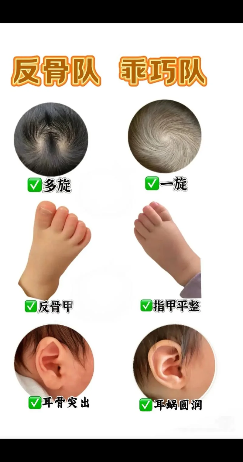 反耳面相-反耳面相