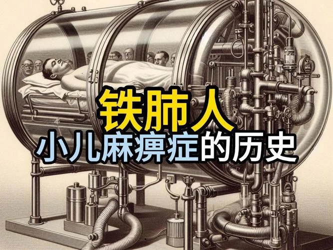 小儿麻痹症的历史故事_1
