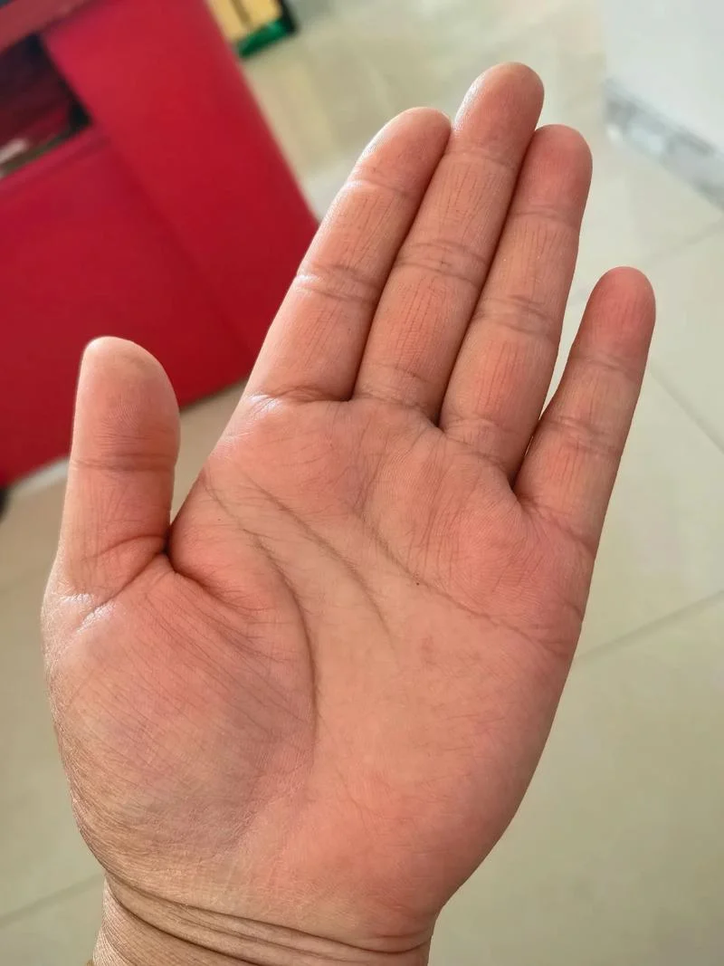 竖纹的手相_2