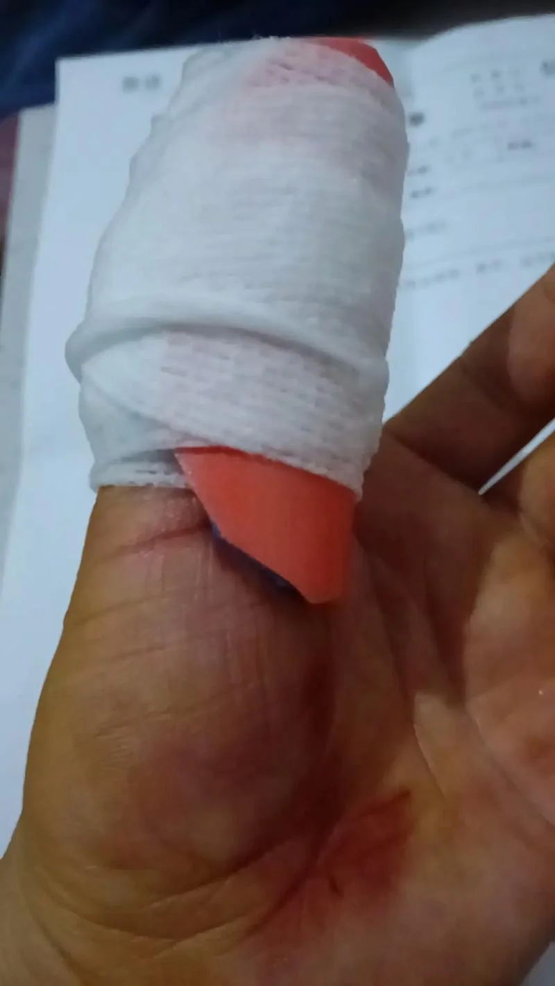 梦见自己手被砍了-梦被砍手