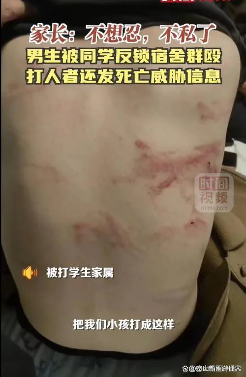 中国留学生殴打同伴-留学生互殴事件