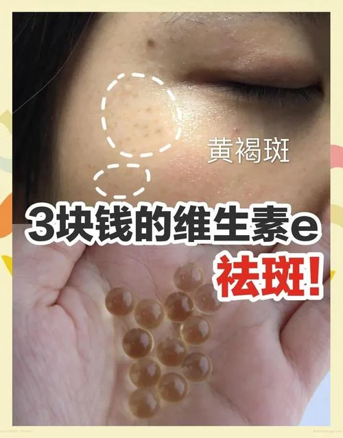 哪个牌子的维生素e淡斑效果好_1