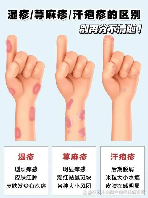 如何用扫一扫查皮肤病_2