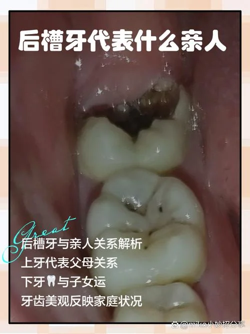 梦见掉假牙_1