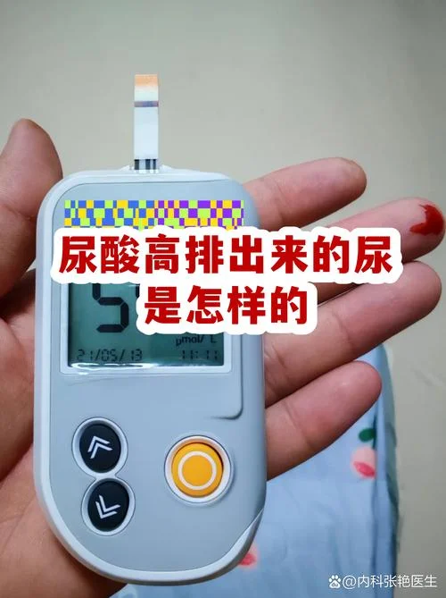 如何查尿酸高_1