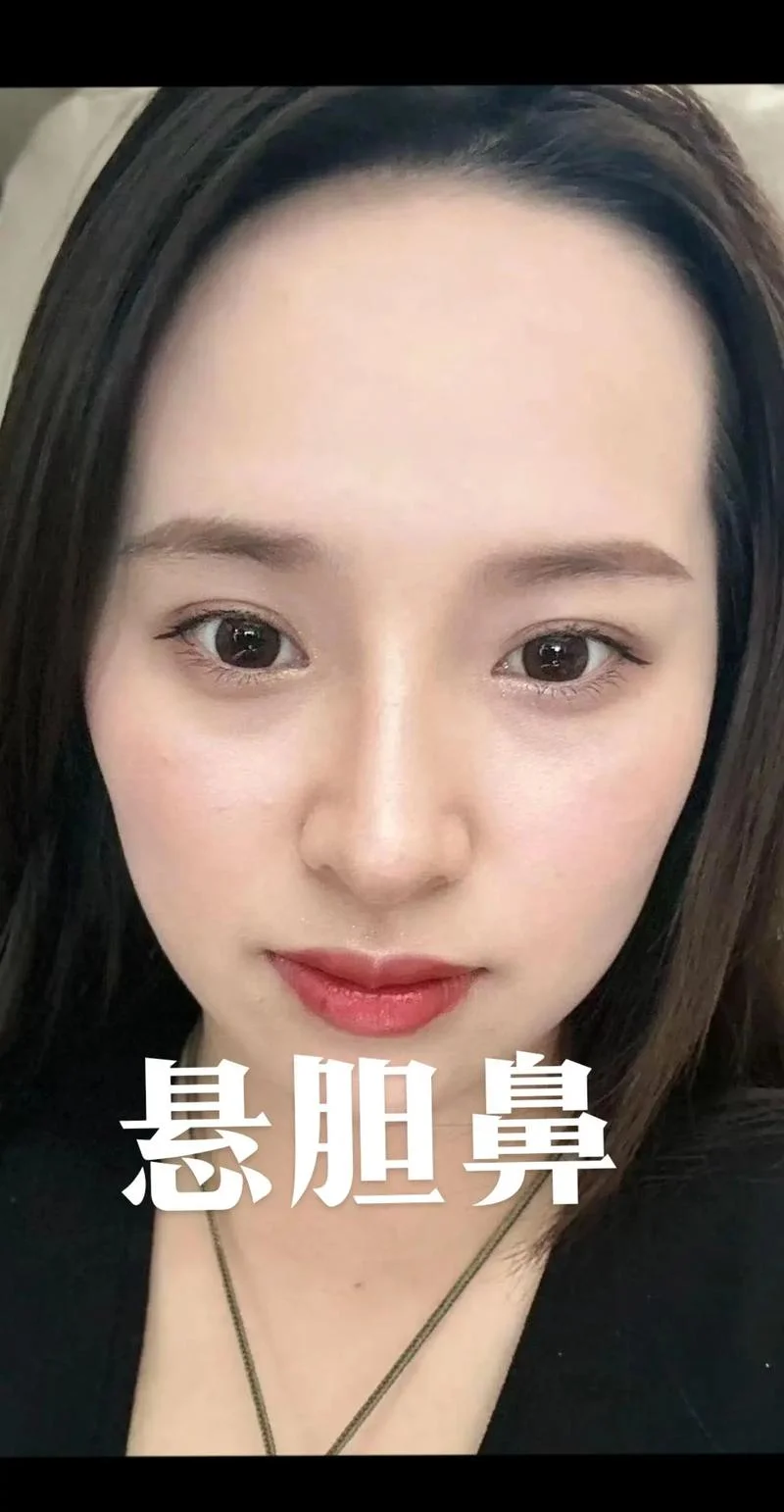 猴鼻面相-猴鼻面相特征