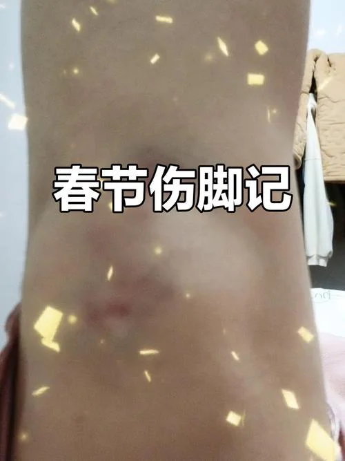 梦见自己的脚受伤了_2