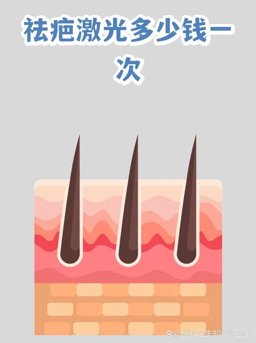 激光祛疤多少钱一平方厘米_1