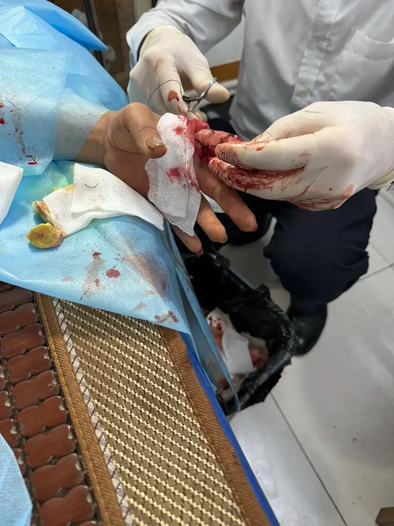梦见手指流血止不住_1