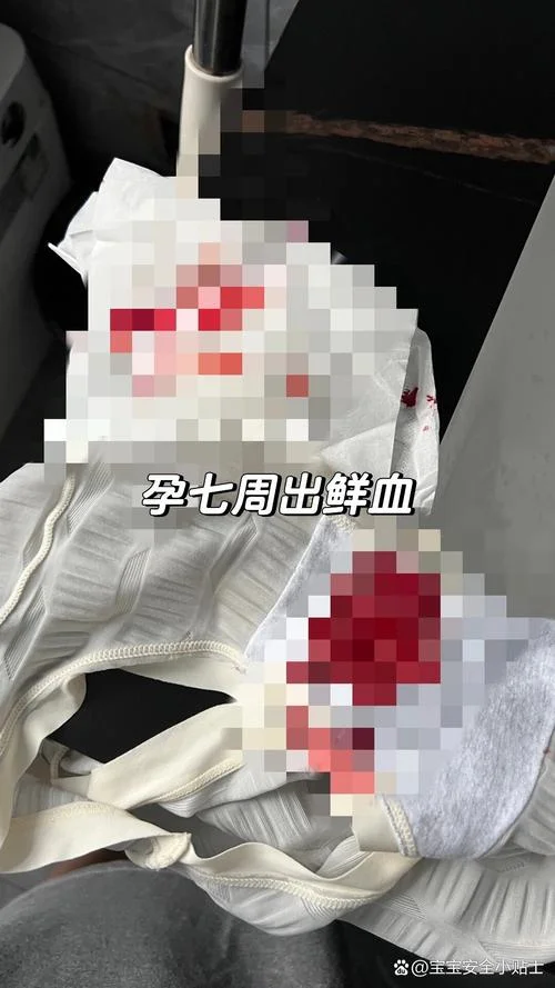 怀孕梦见被追杀见血-怀孕梦见被追杀见血