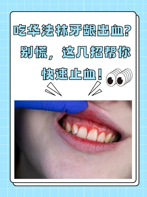 牙龈固定一个地方出血怎么办-牙龈出血需立即就医