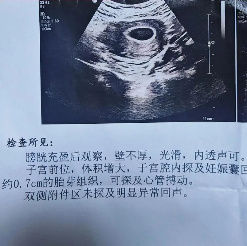 做梦梦到自己生了一个孩子_2