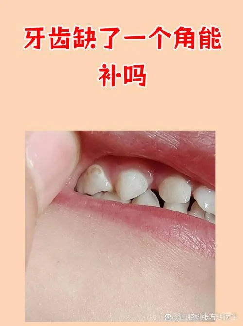 牙釉质受损怎么办-牙釉质受损怎么办？