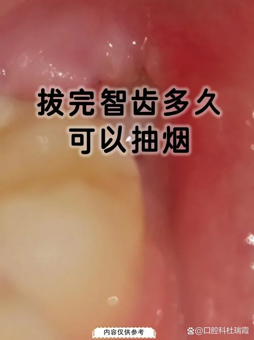 梦到拔牙拔错了_2
