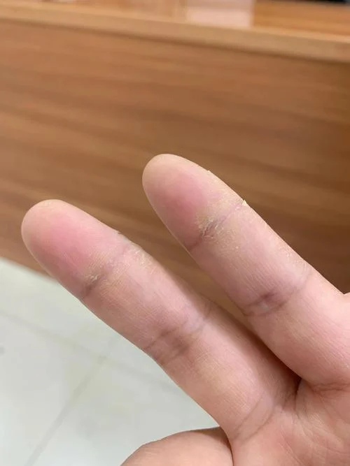 指纹裂开的是什么手相-裂开指纹的手相