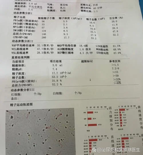 医院如何查精子质量_1