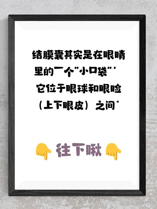 什么是结膜囊在眼睛的什么位置_1