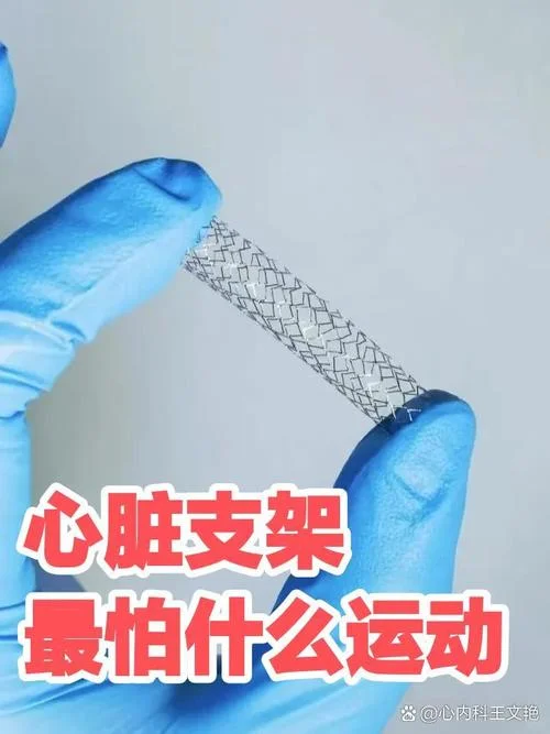心脏支架全称叫什么_2