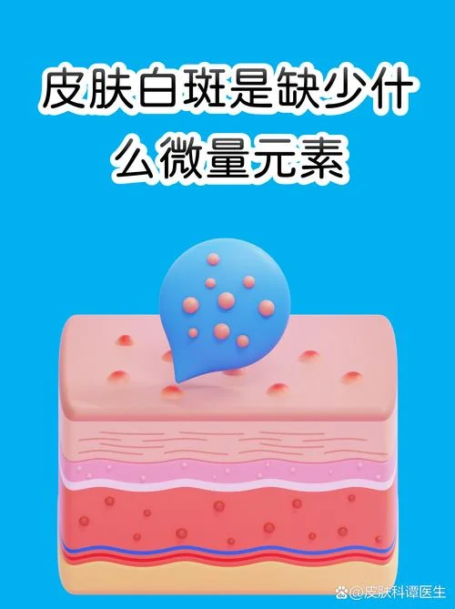缺黑色素是缺什么_1