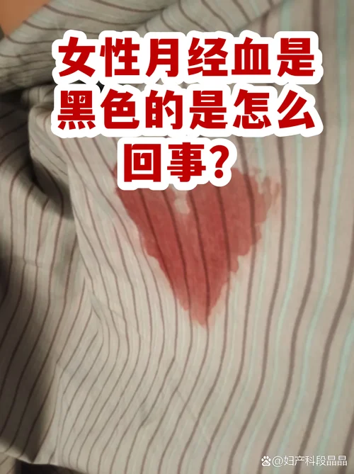 梦到自己月经流好多血_1