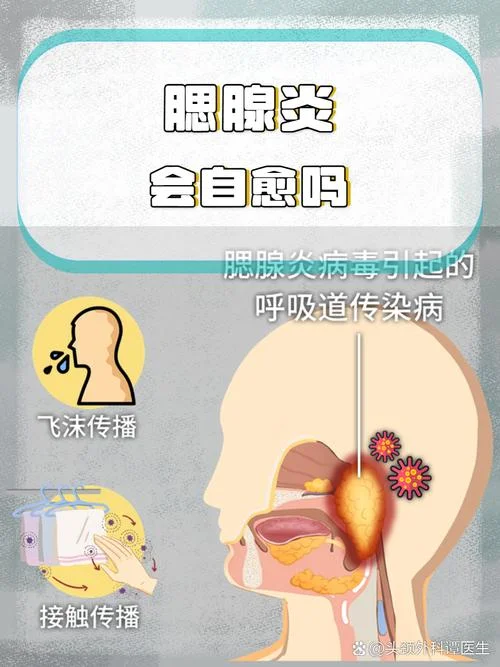 腮腺炎是什么意思_2