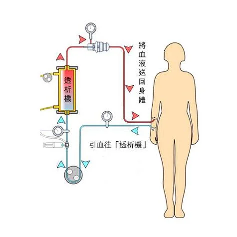 血液透析原理动画_2