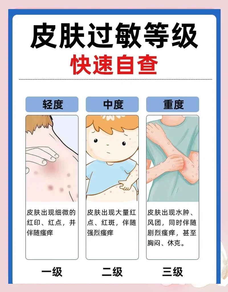 过敏源在哪查好_2