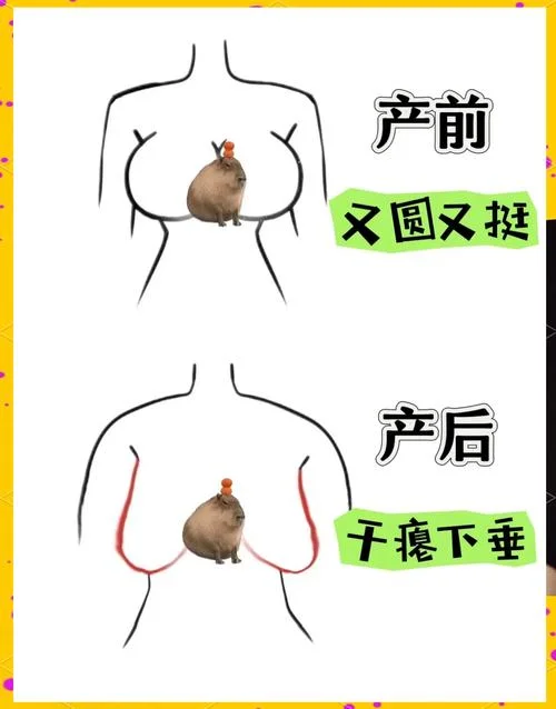 哺乳期胸部下垂了怎么办-哺乳期涨奶需警惕下垂