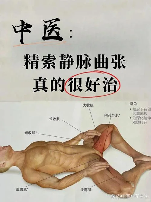 如何查精索静脉曲张_2