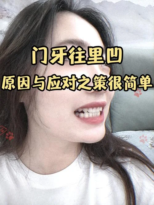牙齿不齐是缺什么原因_2