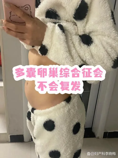 如何查多囊卵巢综合症-多囊查指南