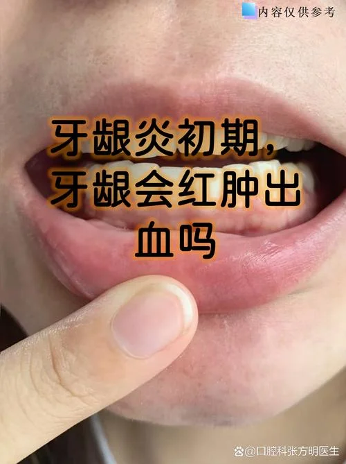 梦见牙龈出血块是什么_2