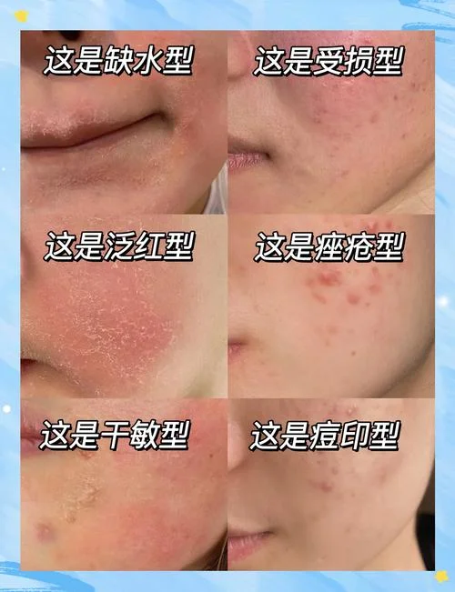 梦见脸脱皮一搓特干净-搓脸脱皮变干净