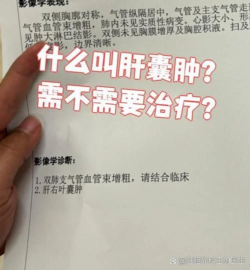肝囊肿多大算严重了_1