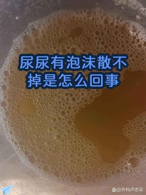 什么样的尿是泡沫尿_1