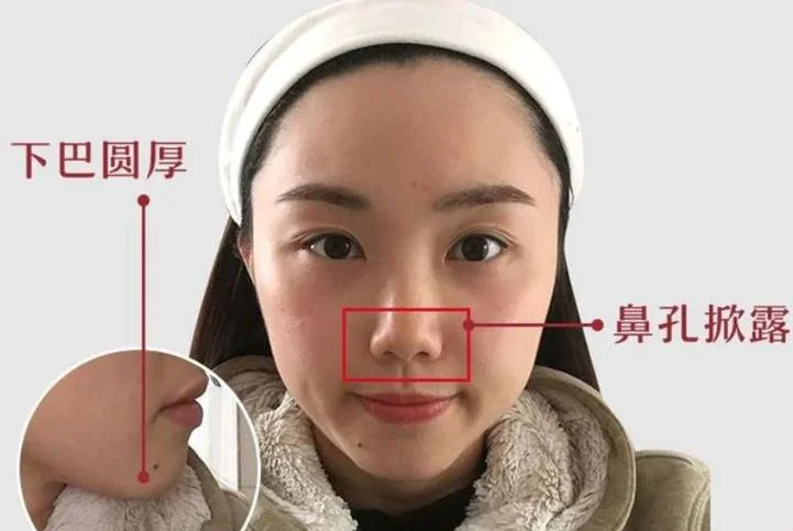 鼻子漏孔面相的女人_2