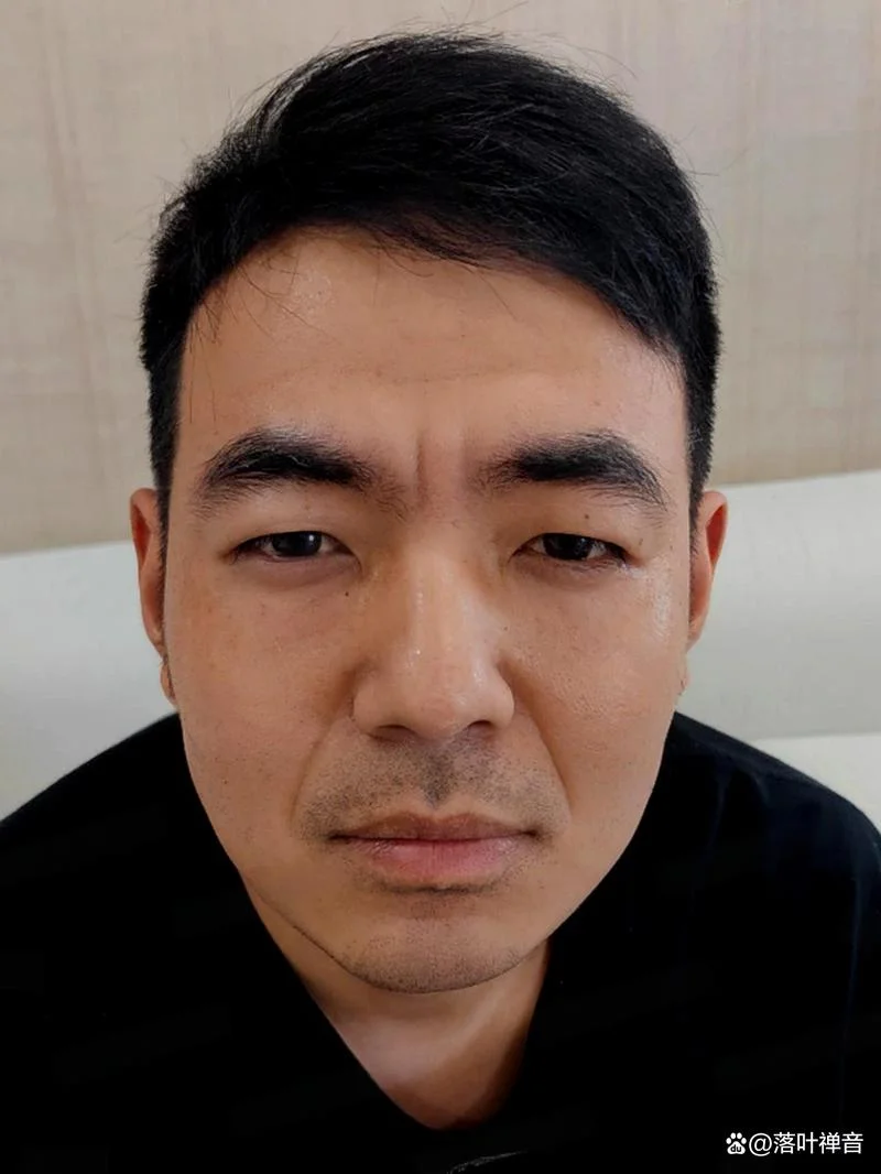 额头两条竖纹叫什么_2