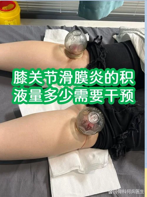 膝关节腔积液怎么办-膝关节腔积液怎么办