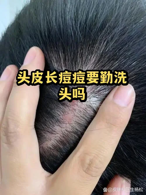 做梦洗头是怎么回事-做梦洗头的寓意