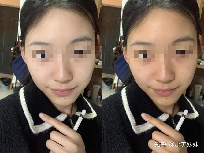 梦见自己变丑了怎么办-梦见变丑怎么办