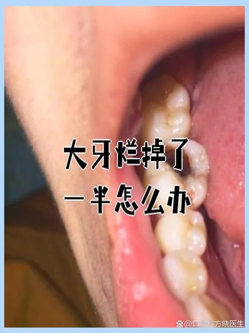 做梦大牙掉了_2