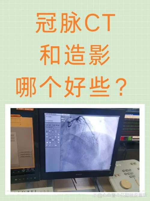 造影是指什么_1