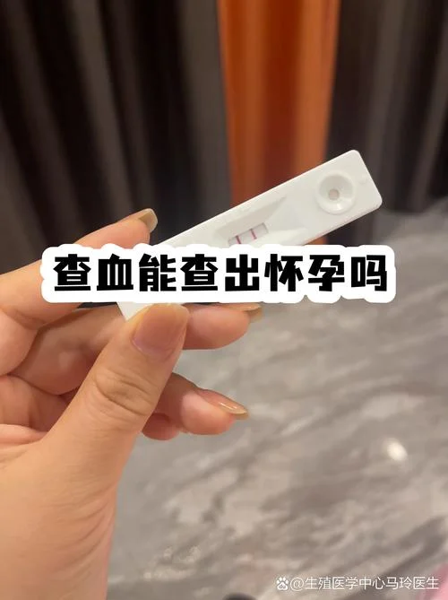 血清人绒毛膜促性腺激素是查什么的_2