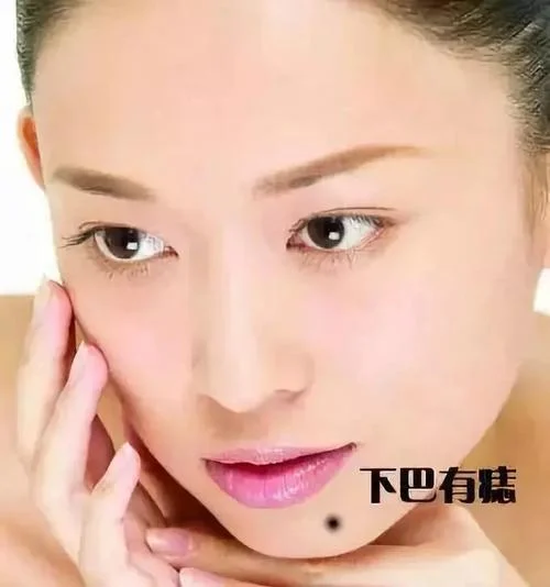 面相下巴有痣-下巴痣面相